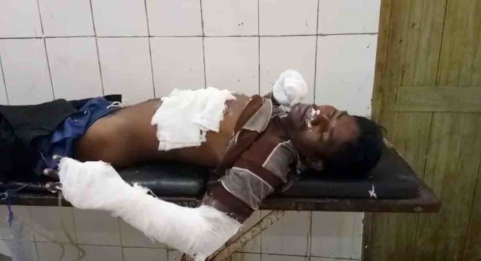 Youth injured while trying to take out transformer Youth injured while trying to take out transformer